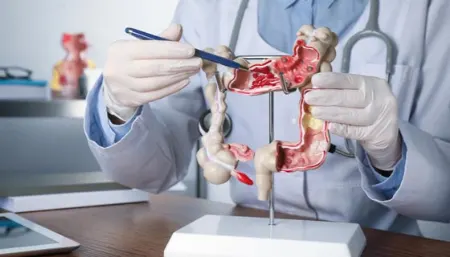 همه‌چیز درباره مگاکولون سمی: علائم، علل و درمان