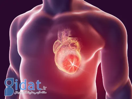 میگزوم قلبی چیست, میگزوم قلبی 