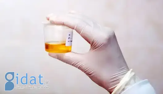 دفع پروتئین در آزمایش ادرار