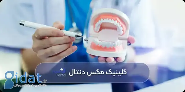 خدمات زیبایی برای دندان در بهترین کلینیک های دندانپزشکی تهران
