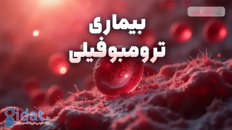 ترومبوفیلی چیست و چگونه درمان می شود؟