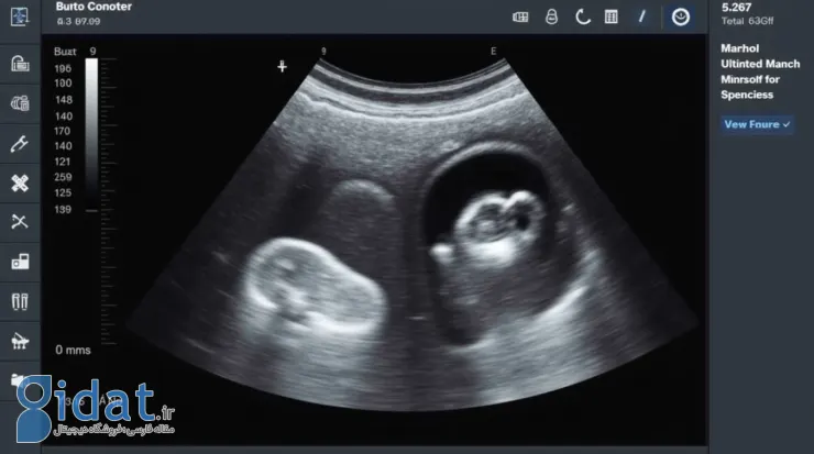 بارداری پوچ