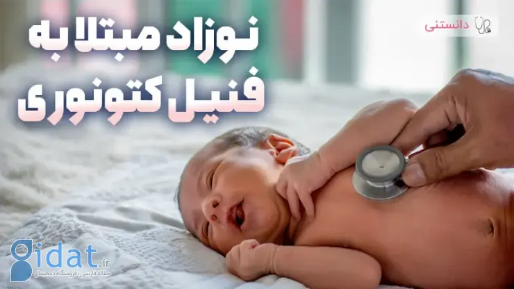 نوزاد مبتلا به فنیل کتونوری