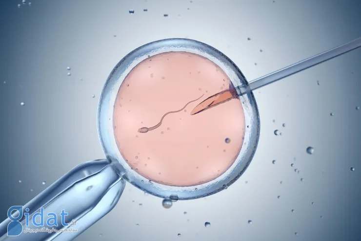 چطور می‌شه ریسک‌های IVF رو کم کرد؟