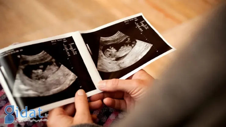 میشه قبل از بارداری تعیین جنسیت کرد؟