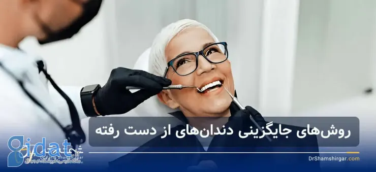 متخصص ایمپلنت دندان در شهرک غرب