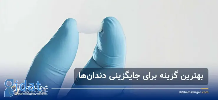 متخصص ایمپلنت دندان در شهرک غرب