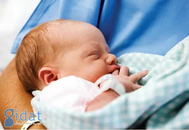 جلوگیری از زردی در نوزادان
