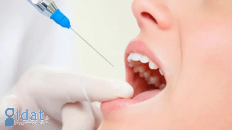 بررسی علل پوسیدگی دندان در شیردهی