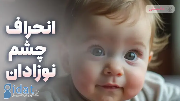 چند ماهگی انحراف چشم نوزادان طبیعی است؟