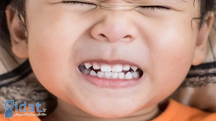 دندان قروچه در کودکان، علل و درمان
