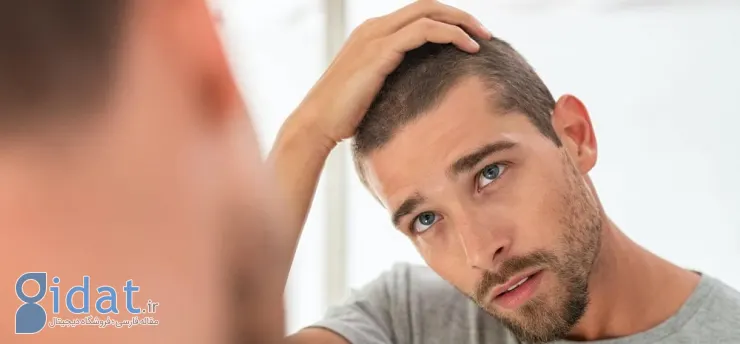 راهکار جلوگیری از ریزش موی آقایان