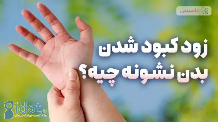 کبودی آسان نشانه چیست؟