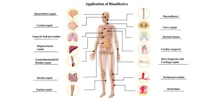 انواع چسب جراحی بافت