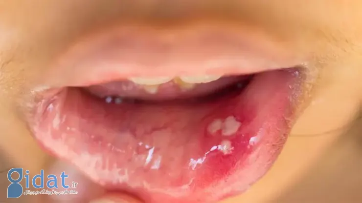 پیشگیری از HPV