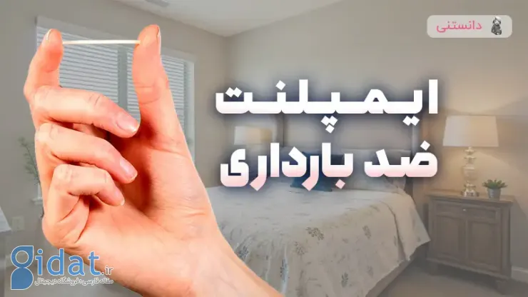 ایمپلنت ضد بارداری