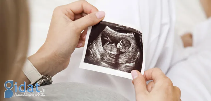 آنچه باید در مورد جفت بارداری بدانید