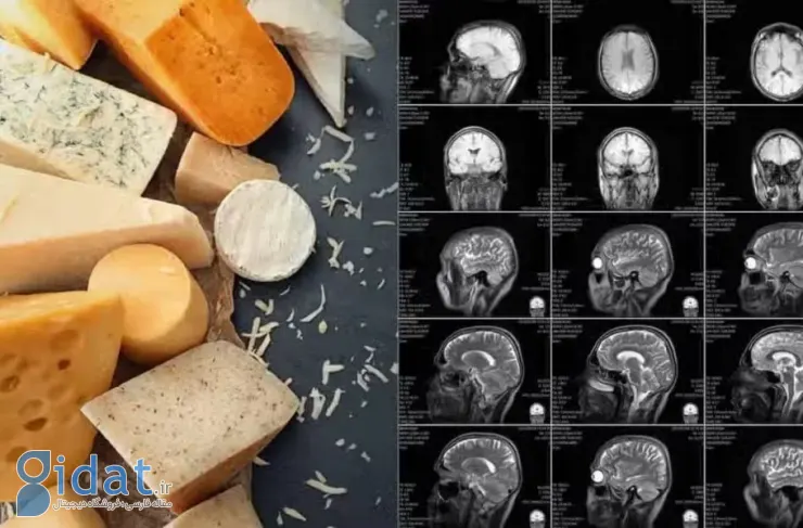 مطالعه جدید: مصرف هفتگی پنیر ممکن است خطر زوال عقل را کاهش دهد