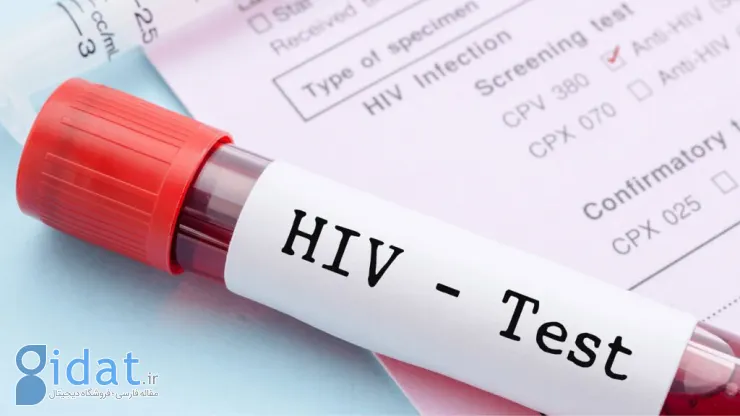 داروی جدید پیشگیری از HIV در آزمایش روی زنان اثربخشی 100 درصدی نشان داد