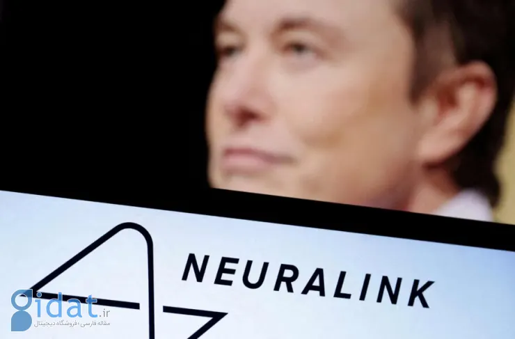 عملکرد تراشه مغزی Neuralink در اولین بیمار انسانی شرکت نشان داده شد [ساعت]