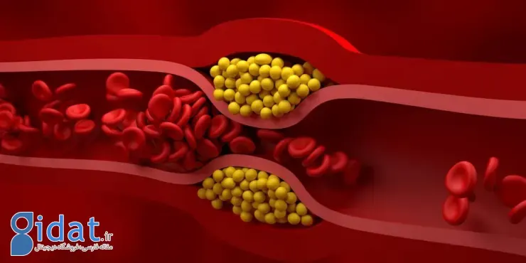 قرص کلسترول