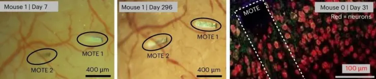 ایمپلنت برای بررسی فعالیتهای مغز
