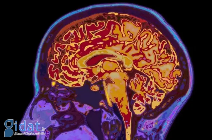 دانشمندان ۵ دوره رشد مغز را کشف کردند؛ مغز انسان تا سن ۳۲ سالگی بالغ نمی‌شود
