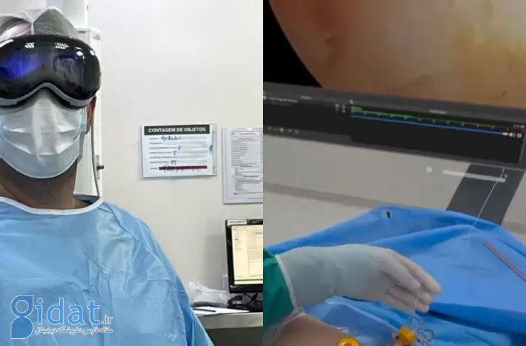 Apple Vision Pro در برزیل برای جراحی آرتروسکوپی شانه استفاده می شود [ساعت]