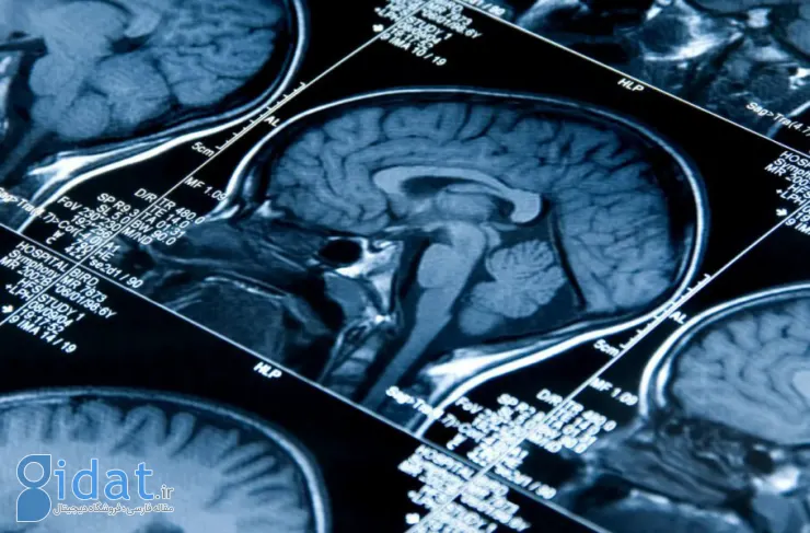 تحقیقات جدید: افراد شبگرد عملکرد مغز بهتری نسبت به افراد صبحگاهی دارند