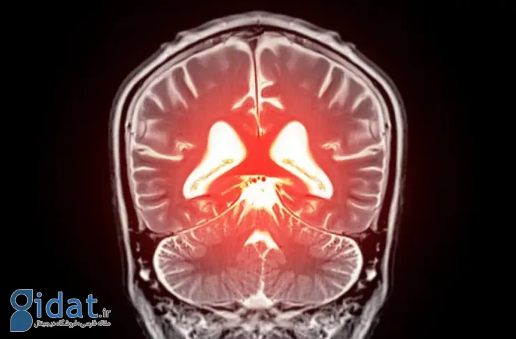 کشف امیدوارکننده برای درمان زوال عقل: کنترل یک پروتئین خاص می‌تواند فشار خون مغز را اصلاح کند