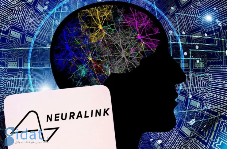 اولین محصول Neuralink به نام 