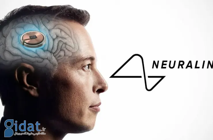 Neuralink، استارتاپ ایمپلنت مغز ایلان ماسک، ۴۳ میلیون دلار سرمایه جدید جذب کرده است