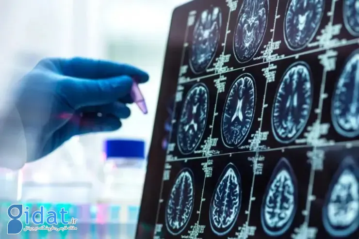 دستاوردهای ۲۰۲۵ پزشکی