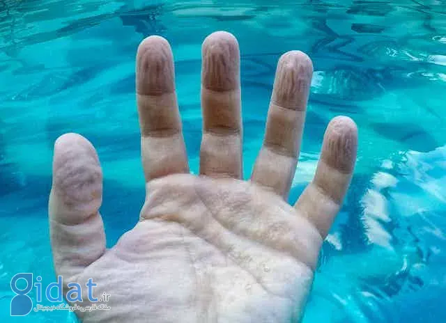 چروک شدن دست در آب