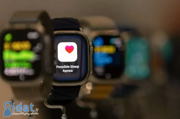 اپلیکیشن جدید محققان، اپل واچ را به یک دستگاه تخصصی نظارت بر خواب تبدیل می‌کند