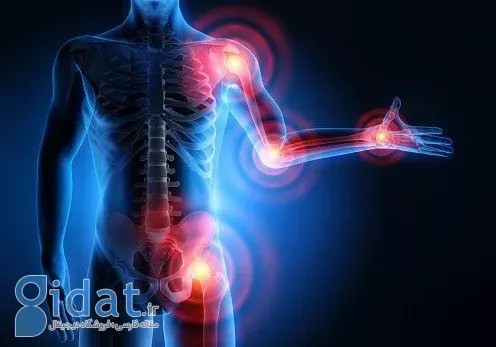 آرتریت واکنشی و سندرم رایتر؛ علائم، تشخیص و درمان