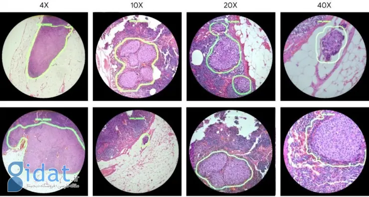 گوگل برای کمک به تشخیص سرطان، میکروسکوپ مبتنی بر هوش مصنوعی می‌سازد