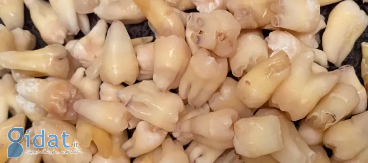 تبدیل سلولهای مغز دندان به نورون