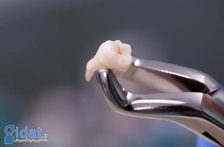 راهی برای درمان بیماری‌های نورودژنراتیو: تبدیل سلول‌های بنیادی دندان به نورون‌ها