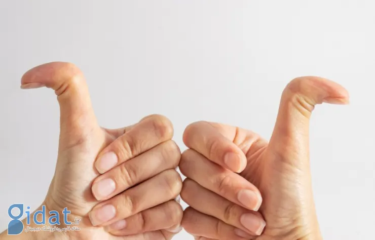 سندروم اهلرز دانلوس