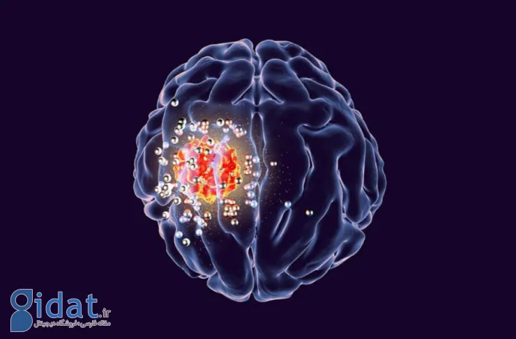 اشعه ایکس با دوز پایین می تواند سلول های تومور مغز را از بین ببرد!