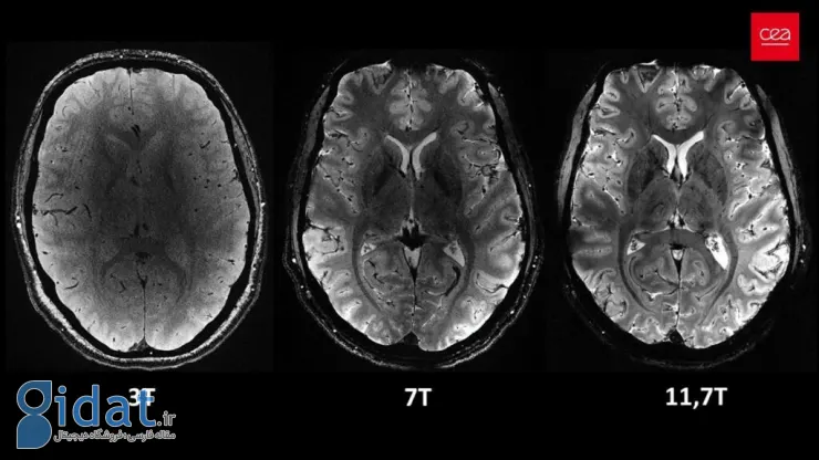 قدرتمندترین دستگاه MRI جهان، اولین تصاویر مغزی خود را با جزئیات بالا ثبت کرد