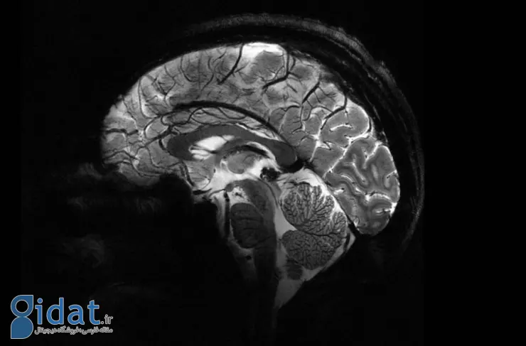 قدرتمندترین دستگاه MRI جهان، اولین تصاویر مغزی خود را با جزئیات بالا ثبت کرد