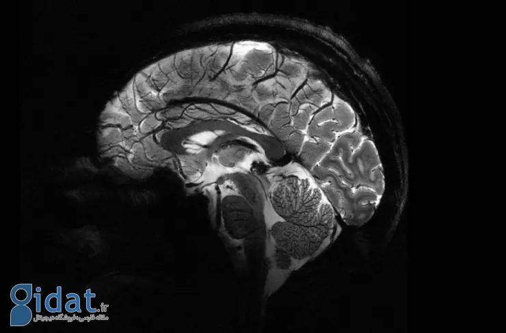 قدرتمندترین دستگاه ام آر آی جهان اولین تصاویر مغز خود را با جزئیات بالا ثبت کرده است