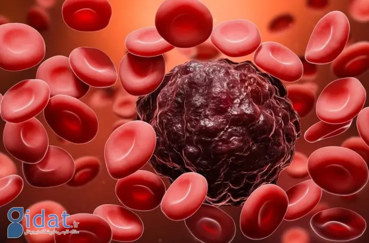 توسعه یک هوش مصنوعی جدید که سرطان خون را با دقت بیشتری نسبت به انسان تشخیص می‌دهد