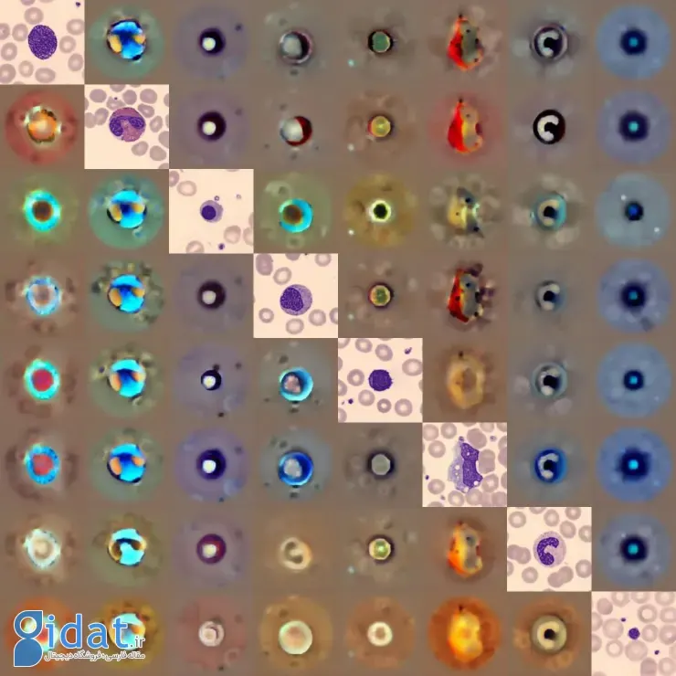 تشخیص سرطان خون با هوش مصنوعی