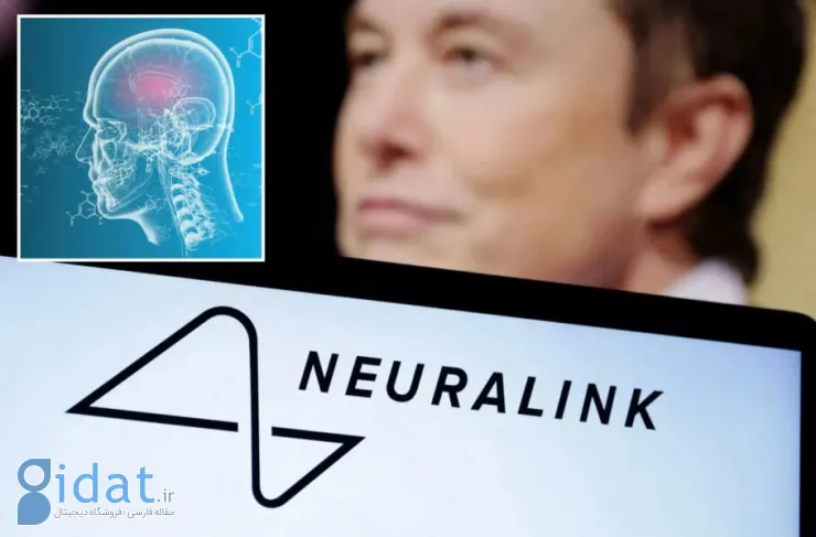 Neuralink تاییدیه کارآزمایی بالینی انسانی خود را از FDA دریافت کرد