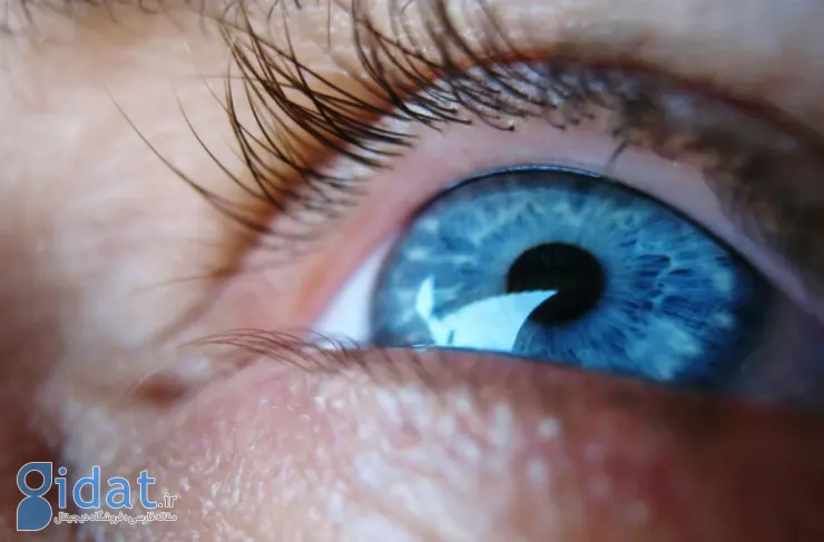 دانشمندان با استفاده از سلول های بنیادی موفق به بازیابی بینایی بیماران شدند