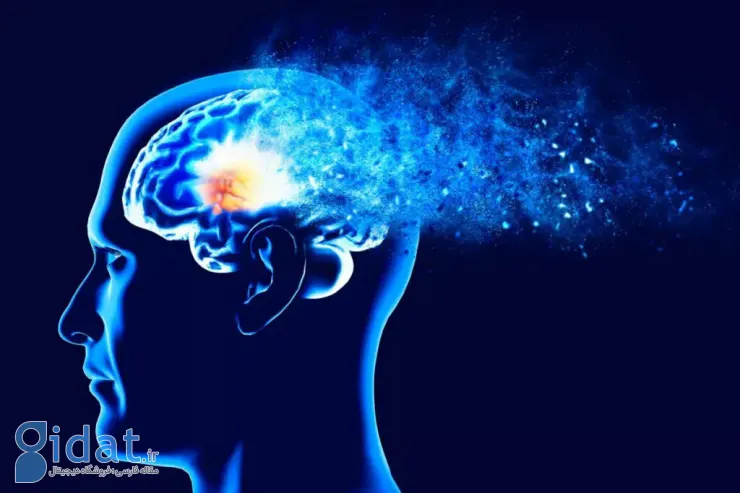  پیشگیری از آلزایمر