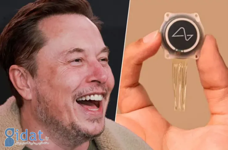 شرکت نورالینک (Neuralink) تولید انبوه ایمپلنت‌های مغزی را در سال ۲۰۲۶ آغاز خواهد کرد
